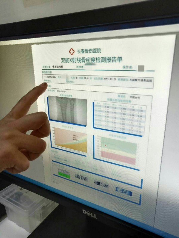 品源雙能X射線骨密度儀落戶吉林省長春骨傷醫(yī)院，助力骨松診療