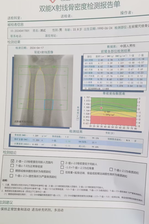 雙能X射線骨密度儀：準確測量骨密度，助力骨質疏松防治，守護骨骼健康